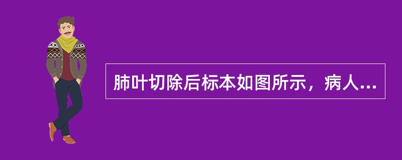 肺叶切除后标本如图所示，病人所患疾病最有可能是()<img style="width: 354px; height: 266px;" src="https://im