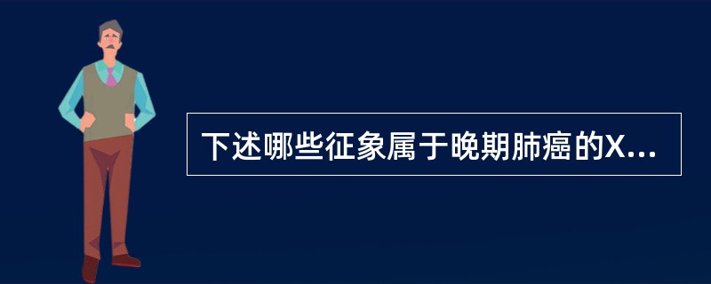 下述哪些征象属于晚期肺癌的X线表现