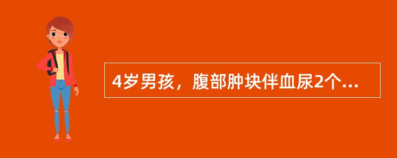 4岁男孩，腹部肿块伴血尿2个月入院，查体：发现右上腹球状肿块，静脉肾盂造影右肾不显影。诊断正确的是()