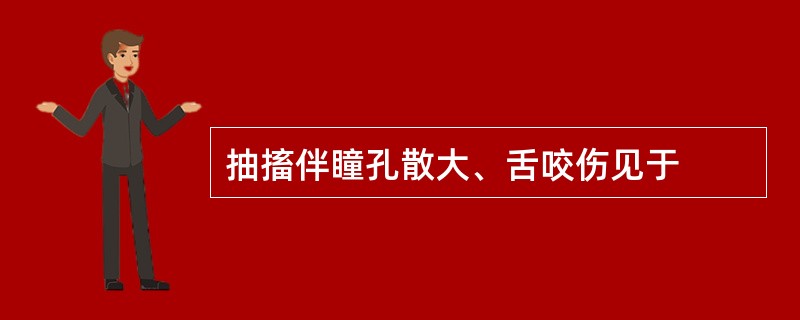 抽搐伴瞳孔散大、舌咬伤见于