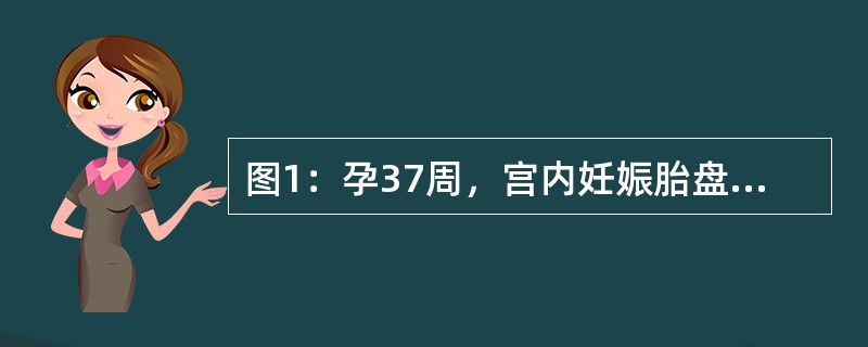 图1：孕37周，宫内妊娠胎盘扫查。图2：孕38周，宫内妊娠胎盘扫查。按胎盘分级，图1、图2胎盘应属哪级胎盘：<img border="0" style="width