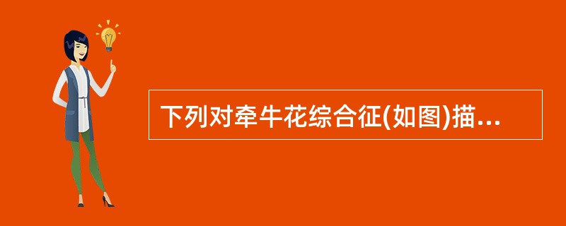 下列对牵牛花综合征(如图)描述错误的是()<img border="0" style="width: 222px; height: 166px;" src