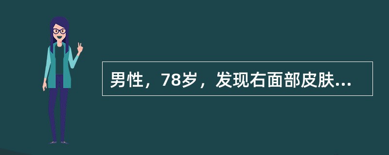 男性，78岁，发现右面部皮肤表面肿物10年，最初直径0cm，后缓慢增大至2.0cm，质硬，表面呈蜡状，边缘不齐。下列哪项诊断可能性大