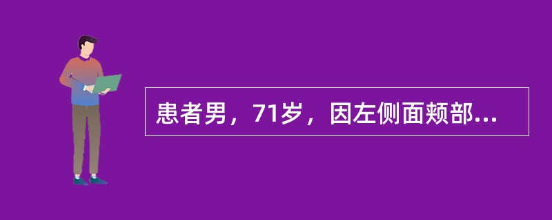 患者男，71岁，因左侧面颊部疼痛三年入院，疼痛为针刺样，分布在左唇部及鼻翼旁，每次发作持续5～20秒钟，吃饭，说话等可诱发疼痛。口服卡马西平0.1tid，效果欠佳，加量后伴有头晕症状。经完善辅助检查，