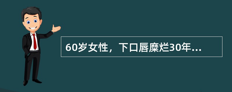 60岁女性，下口唇糜烂30年，诊断为红斑狼疮。1年来下唇出现一肿物。检查发现下唇约2cm×3cm×1cm大小菜花状增生物，伴破溃，有臭味。下列哪项检查最有助于诊断