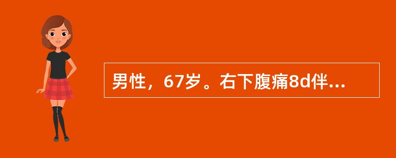 男性，67岁。右下腹痛8d伴呕吐，体温35℃，脉搏120次/分，血压10.7/6.67kPa(80/50mmHg)，神志不清，烦躁不安，全腹压痛、反跳痛.四肢冰冷、青紫呈花斑发绀，尿量＜25ml/h。