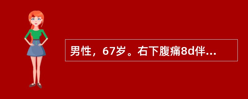 男性，67岁。右下腹痛8d伴呕吐，体温35℃，脉搏120次/分，血压10.7/6.67kPa(80/50mmHg)，神志不清，烦躁不安，全腹压痛、反跳痛.四肢冰冷、青紫呈花斑发绀，尿量＜25ml/h。