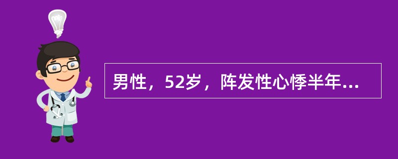 男性，52岁，阵发性心悸半年，时有胸闷，登二楼觉气急3个月，下肢浮肿3天来门诊。心电图示窦性心律，心率64次／分，P-R间期0.24s，伴完全性右束支传导阻滞，诊断为扩张型心肌病。心功能不全。入院后予