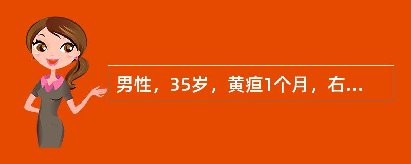 男性，35岁，黄疸1个月，右上腹轻微胀痛，食欲减退，经内科治疗无效。查体：肝大，胆囊增大，血胆红素17μmol/L，AST70U/L，AKP45U/L，AFP＞5ng／ml，可能诊断是（）