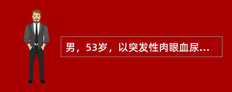 男，53岁，以突发性肉眼血尿就诊。体查：左腹可触及肿块，有轻压痛。肾盂造影可见左肾盏肾盂拉长，受压变形。右肾未显影。如MRU提示左肾盂充盈缺损。最可能的诊断是()