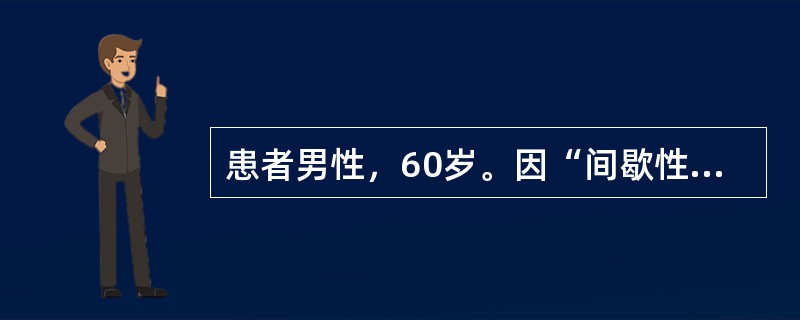 患者男性，60岁。因“间歇性无痛性全程肉眼血尿10天”就诊。无尿频、尿急、尿痛及排尿费力症状。以下最有可能的诊断是()【提示】患者B超检查提示右肾中度积水，右输尿管上段扩张；左肾、输尿管和膀胱未见异常