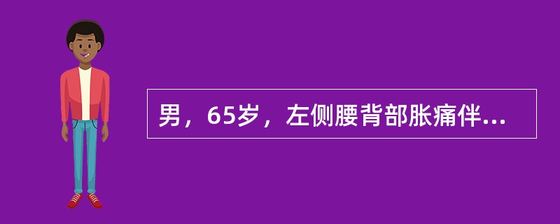 男，65岁，左侧腰背部胀痛伴无痛性全程血尿3个月余，CT平扫及增强检查如图所示，下列说法正确的是()<img border="0" style="width: 20