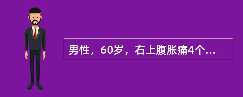 男性，60岁，右上腹胀痛4个月伴黄疸1个月余。体格检查：肝肋下4cm，剑突下5cm，质硬，移动性浊音(+)可能引起该患者死亡的最少见病因是()