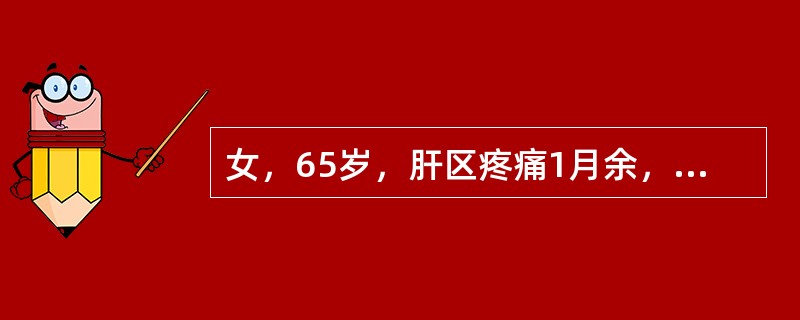 女，65岁，肝区疼痛1月余，CT检查如图，最可能的诊断是()<img border="0" style="width: 210px; height: 158px;&