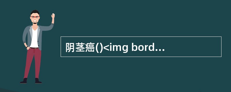 阴茎癌()<img border="0" style="width: 201px; height: 151px;" src="https://i