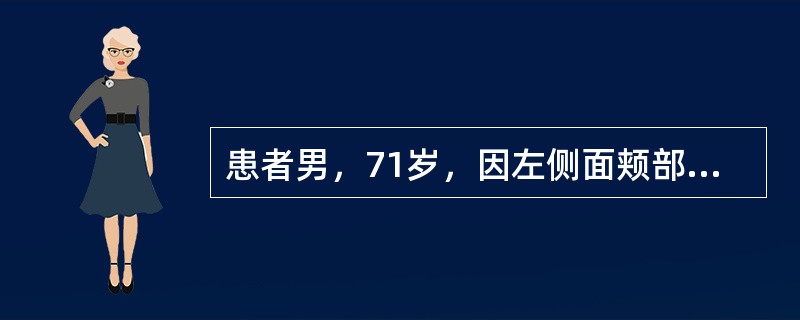 患者男，71岁，因左侧面颊部疼痛三年入院，疼痛为针刺样，分布在左唇部及鼻翼旁，每次发作持续5～20秒钟，吃饭，说话等可诱发疼痛。口服卡马西平0.1tid，效果欠佳，加量后伴有头晕症状。三叉神经痛临床表