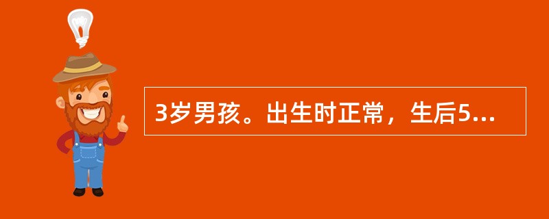 3岁男孩。出生时正常，生后5个月开始出现表情呆滞，有间断癫痫发作，常有呕吐，目前智力明显落后，肌张力增高，头发黄，皮肤白皙。尿有鼠尿臭味。目前针对该患儿采取的主要治疗措施是