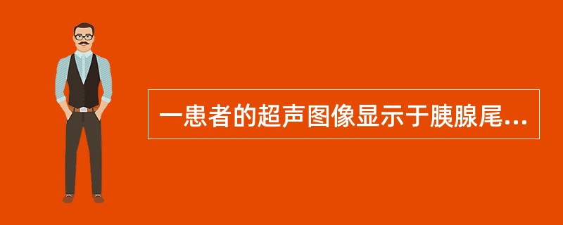 一患者的超声图像显示于胰腺尾部可见一包膜光整的多房性囊性结构，囊壁较厚并伴乳头状结节及钙化斑附着，囊腔内透声良好，可见较粗大的高回声光带分隔。最可能的诊断是（）