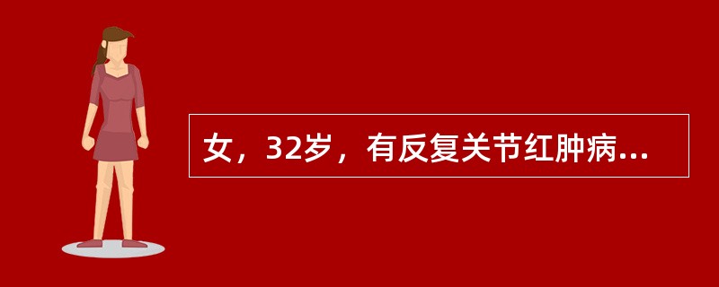 女，32岁，有反复关节红肿病史，因活动后心悸、突发呼吸困难及咳粉红色泡沫痰入院。查体：心尖区舒张期隆隆样杂音，双肺布满水泡音。心电图示心动过速，二尖瓣型P波。最可能的诊断是