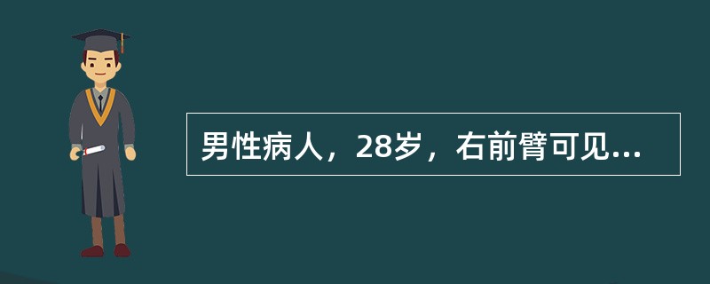 男性病人，28岁，右前臂可见大片红斑，其上可见针头粟粒大小丘疱疹，有明显浆液性渗出，诊断为急性湿疹以下哪种治疗方法最为合适
