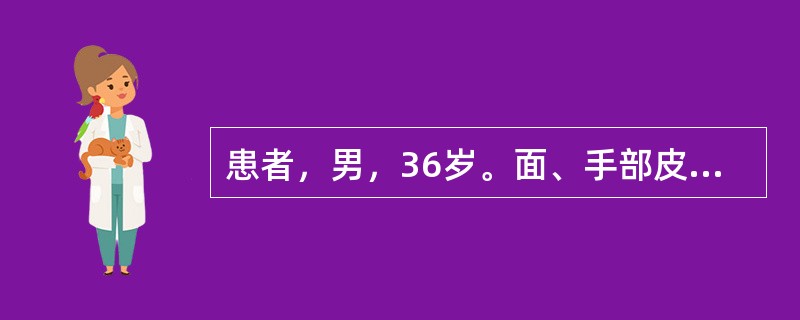 患者，男，36岁。面、手部皮疹1年，1年前冬季开始出现皮疹，皮疹轻度痒，日晒后加重，不伴有其他症状。体格检查：一般情况尚可，系统检查无异常。颧、鼻、外耳、手背部见暗红色斑块，表面附黏着性鳞屑，皮损中央