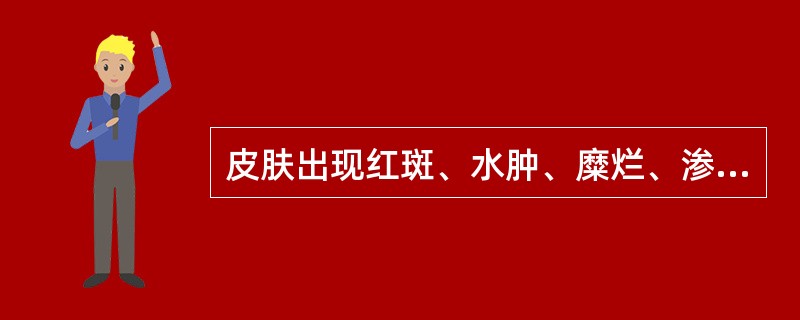 皮肤出现红斑、水肿、糜烂、渗液，外用药首选