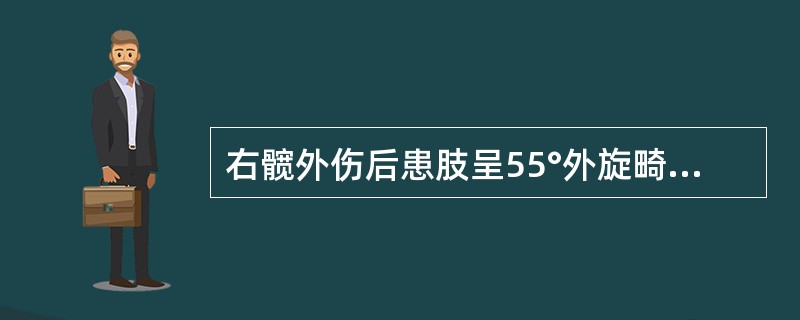 右髋外伤后患肢呈55°外旋畸形，最可能的诊断是