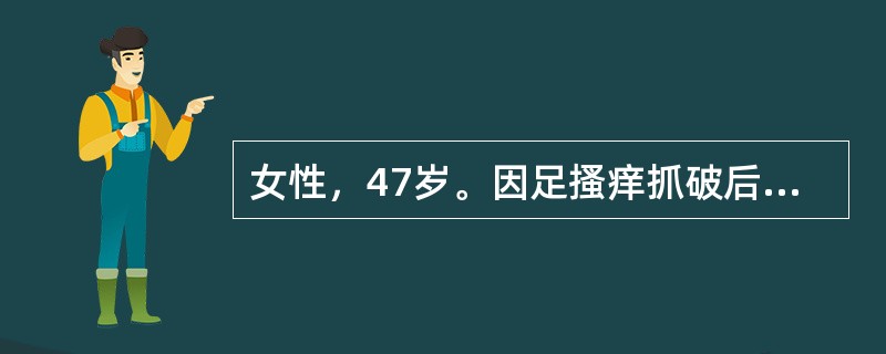 女性，47岁。因足搔痒抓破后皮肤破溃，继而于小腿及大腿中下段出现一红线，压痛，患肢轻度肿胀，诊断考虑为