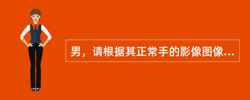 男，请根据其正常手的影像图像，判断其最可能的年龄()<img border="0" style="width: 333px; height: 250px;"