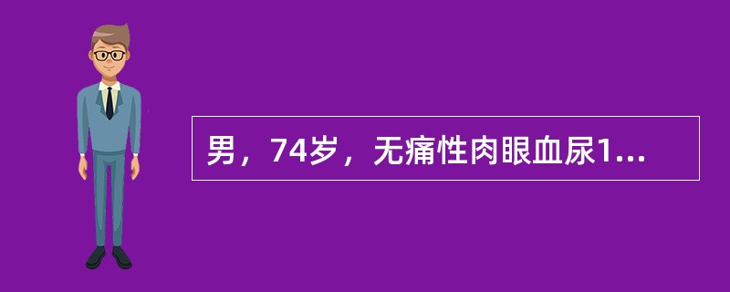 男，74岁，无痛性肉眼血尿1个月余，CT扫描如图所示，该疾病最可能的诊断为()<img border="0" style="width: 201px; height