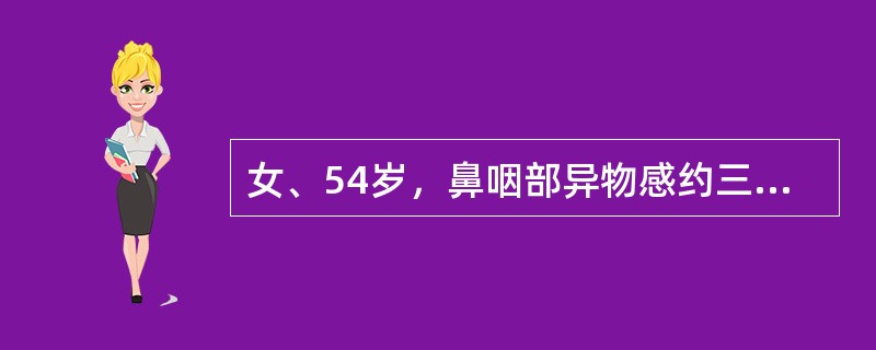 女、54岁，鼻咽部异物感约三个月，PE：左侧声带固定，可见肿物，CT如图所示，应诊断为()<img border="0" style="width: 182px;