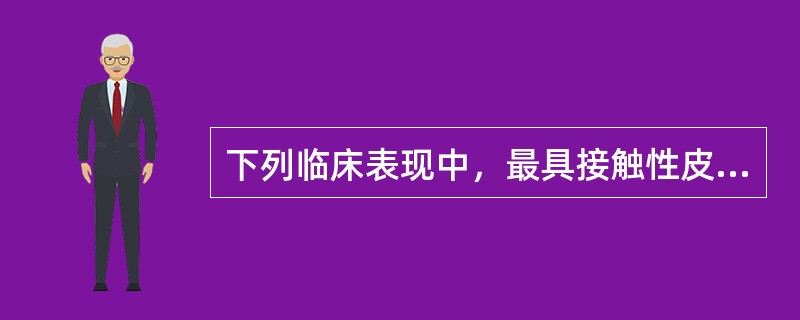 下列临床表现中，最具接触性皮炎特征的是