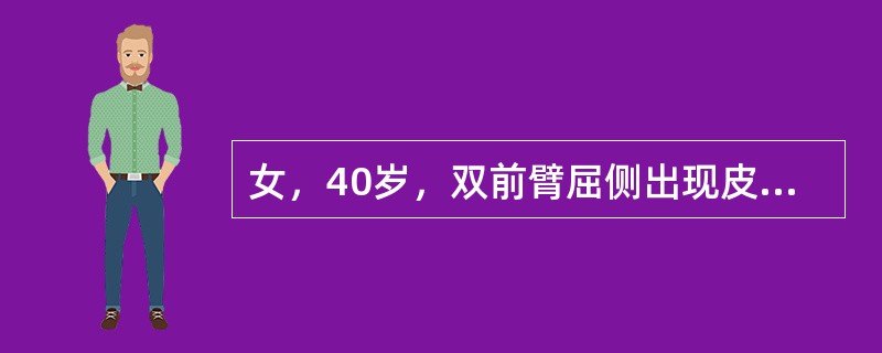 女，40岁，双前臂屈侧出现皮疹半年，伴瘙痒，体检：双前臂屈侧可见散在红色、紫红色多角形扁平丘疹，表面覆白色角质薄膜，有蜡样光泽，口腔里黏膜可见乳白色网状白纹。最可能的诊断是