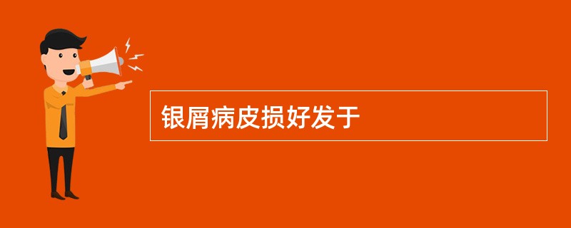 银屑病皮损好发于