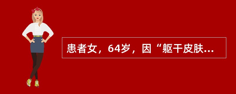 患者女，64岁，因“躯干皮肤反复红斑、丘疹、渗出、脱屑3年”来诊。5年前诊断为“尿崩症”，一直口服“醋酸去氨加压素，每次4片，每日1次”治疗。查体：眼球轻度突出；双肺呼吸音清，未闻及干、湿性啰音；双颌