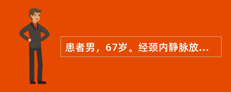 患者男，67岁。经颈内静脉放置肺动脉导管，RAP20mmHg，CI2.0L·min·m，PAP25/13mmHg，PCWP10mmHg。关于经颈内静脉置入肺动脉导管，叙述正确的是