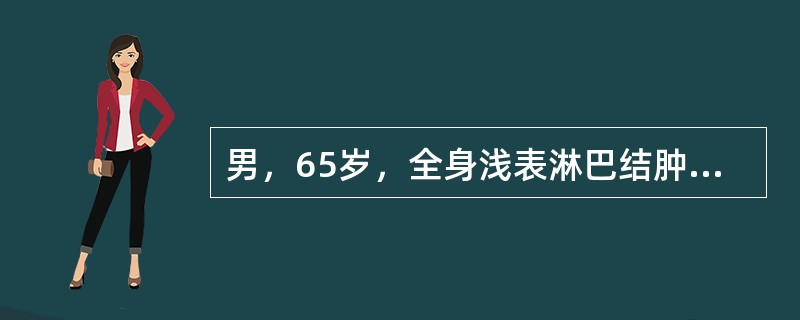 男，65岁，全身浅表淋巴结肿大，请根据所示图像，选择最可能诊断()<img border="0" style="width: 201px; height: 151p