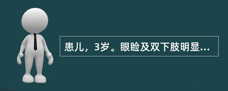 患儿，3岁。眼睑及双下肢明显水肿，少尿1周。体检：精神状态尚好，眼睑水肿，双下肢呈凹陷性水肿，血压12/8kPa（90/60mmHg），心肺正常，尿常规：蛋白（+++），红细胞0～3个/HP，血浆总蛋