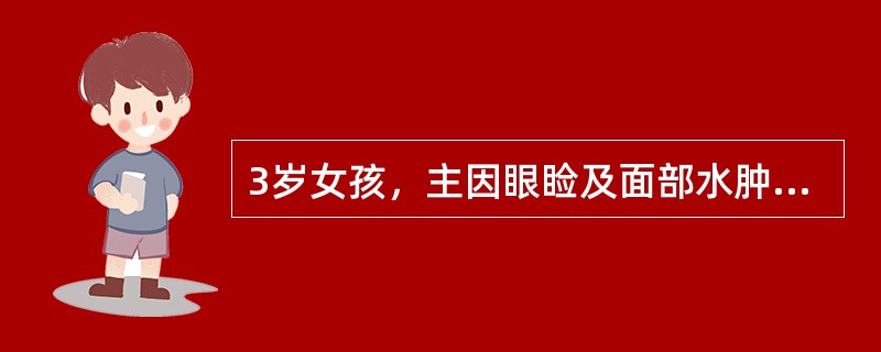 3岁女孩，主因眼睑及面部水肿两周就诊。查体：血压90/68mmHg，全身高度水肿呈凹陷性。实验室检查尿蛋白++++，尿红细胞1～2/HP。肾病综合征，首选应用的细胞毒药物是