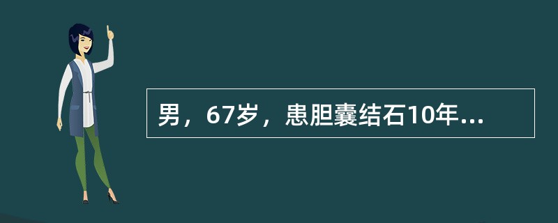 男，67岁，患胆囊结石10年，突然上腹部疼痛，伴恶心、呕吐、发热，体温37．8℃，体检墨菲征(-)，中上腹部压痛，血尿淀粉酶升高，最可能的诊断为