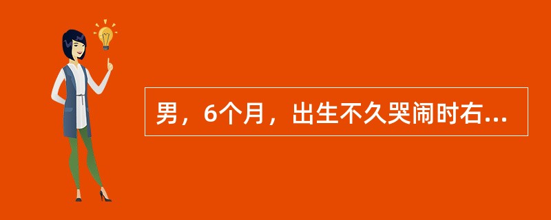 男，6个月，出生不久哭闹时右阴囊有一包块，平卧安静时包块明显缩小或消失。2小时前因哭闹包块掉出，伴呕奶、不停哭闹、精神萎糜，右阴囊可见一似梨状包块。最有可能诊断是