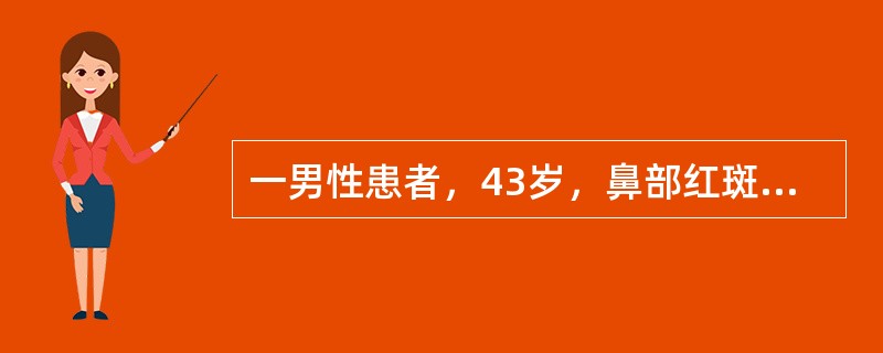 一男性患者，43岁，鼻部红斑5年，渐加重。嗜酒。体检：鼻尖部红斑、表面毛细血管扩张、丘疹、脓疱和结节。以下哪项诊断正确