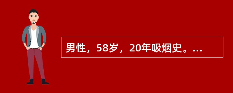 男性，58岁，20年吸烟史。刺激性咳嗽并痰中带血丝6个月，胸片示左肺中央型块影，