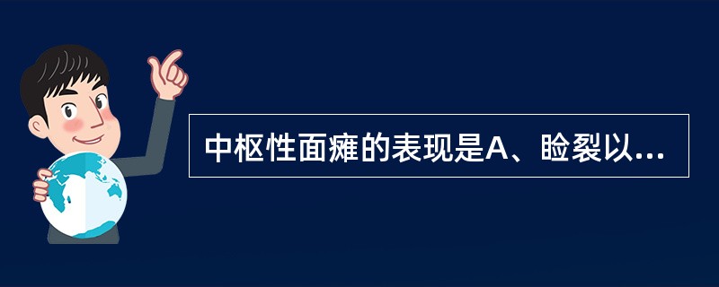 中枢性面瘫的表现是A、睑裂以下表情肌瘫痪B、一侧面瘫£«味觉丧失C、单纯一侧完全