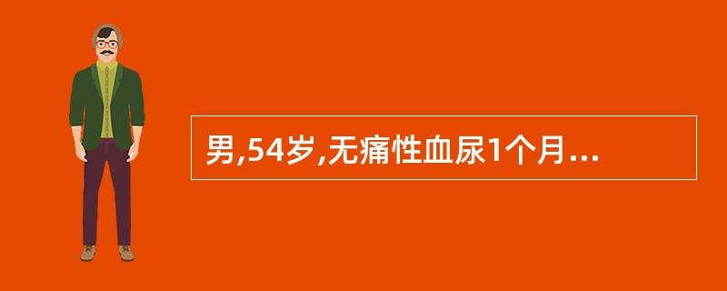 男,54岁,无痛性血尿1个月余,根据所示图像,最可能的诊断是