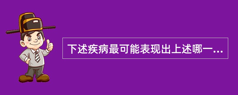 下述疾病最可能表现出上述哪一种性质的疼痛，急性牙髓炎