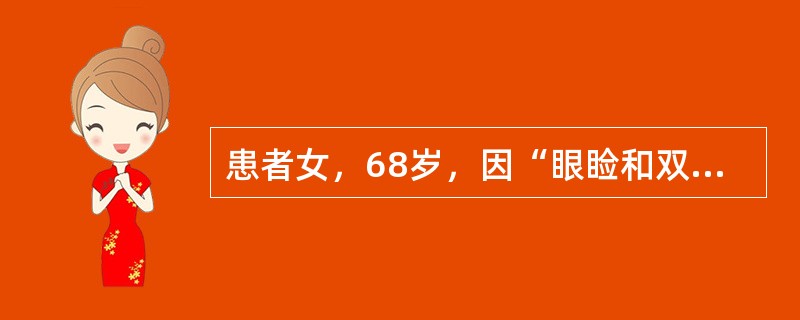 患者女，68岁，因“眼睑和双下肢水肿15d，夜间随地排尿、粪”来诊。患者有糖尿病
