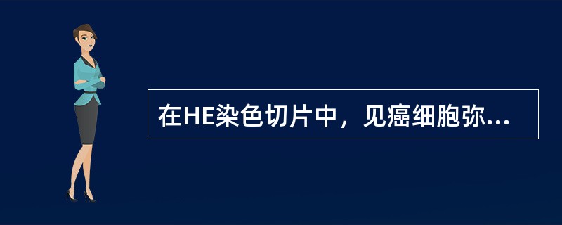在HE染色切片中，见癌细胞弥漫浸润于胃粘膜下层及肌层，有大量淡蓝色均质无结构物质