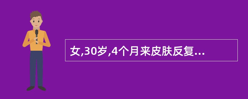 女,30岁,4个月来皮肤反复出现紫癜来诊。查体:巩膜无黄染,胸骨无压痛,肝脾未触