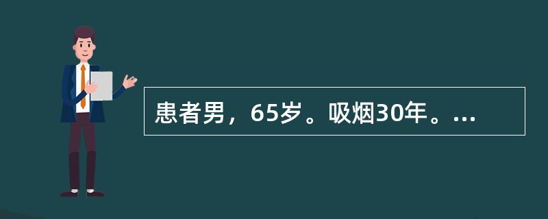 患者男，65岁。吸烟30年。1周来反复发作胸痛，与体力活动有关，休息可以缓解。6小时前出现持续性疼痛，进行性加剧，伴气促，不能平卧。查体：神志清楚，BP90/65mmHg，HR120次／分，律齐，心尖